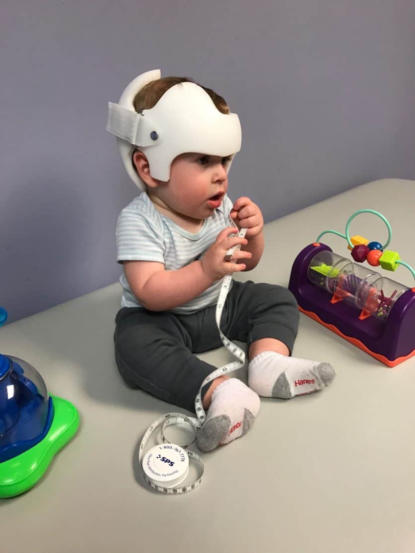 Why My Baby Wears a Cranial Helmet