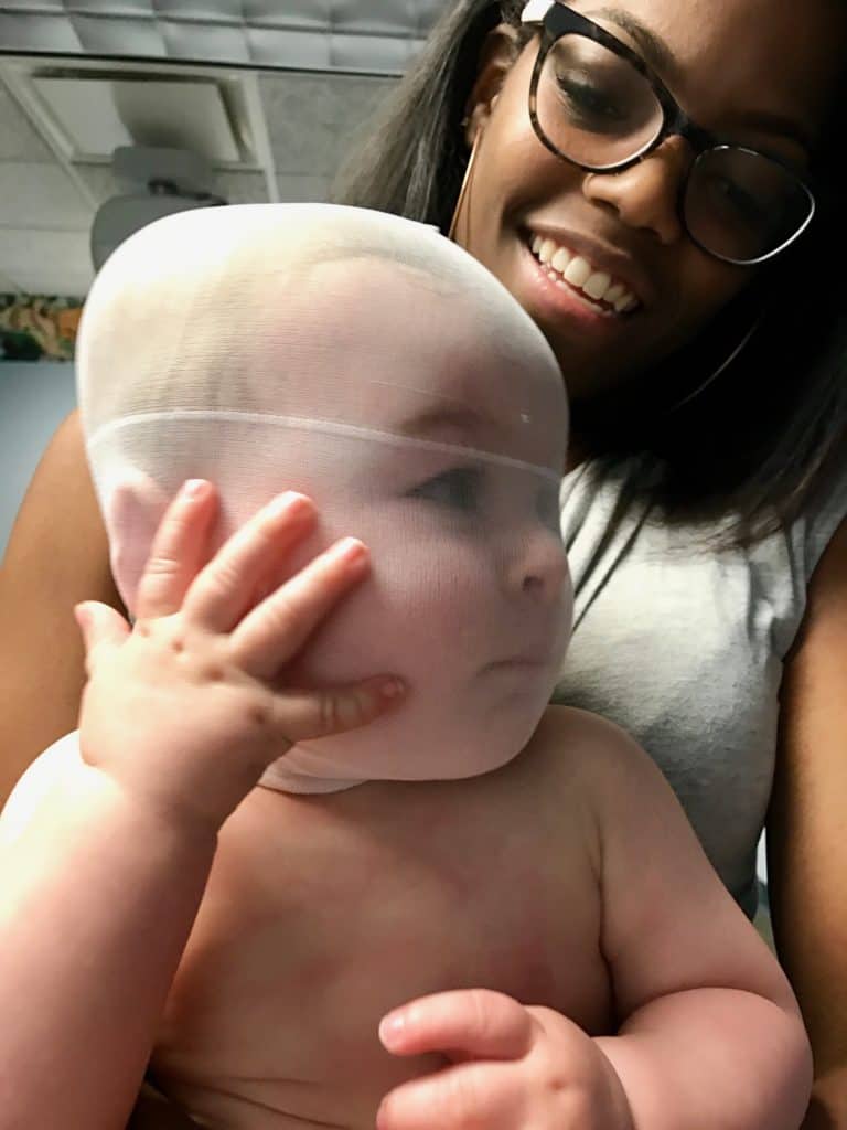 Cranial Technologies - Check out this DOC Band Baby in the arms of